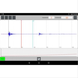 SONIC15 Instrumento Para Teste de Velocidade de Pulso Ultrassónico MYJ